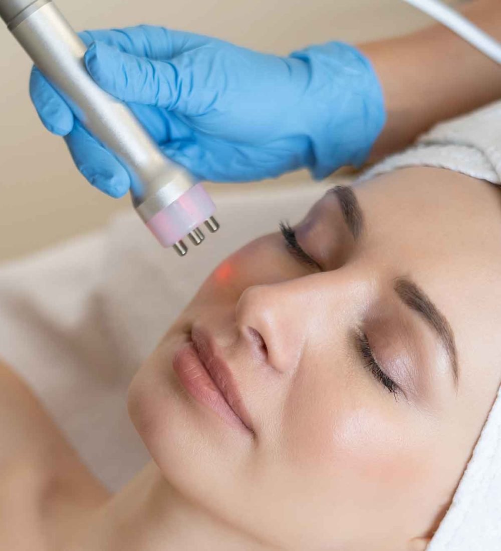 radiofrequency
